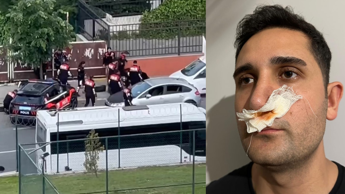 İstanbul'da polise yumruklu saldırı: 4 gözaltı