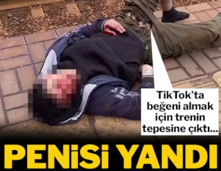 15 yaşındaki çocuk TikTok videosu çekerken ölümden döndü: Penisi yandı