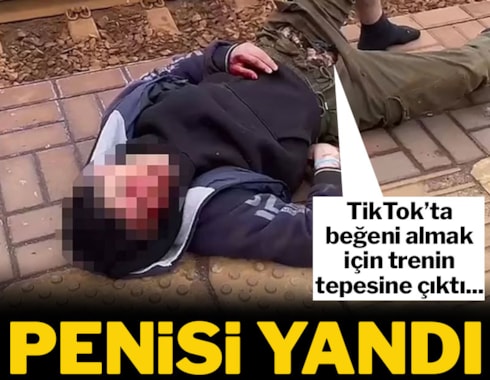 15 yaşındaki çocuk TikTok videosu çekerken ölümden döndü: Penisi yandı