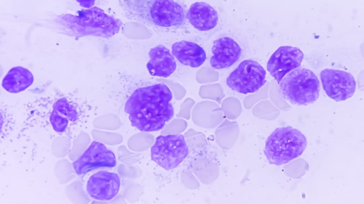 Oxford Üniversitesi'nden kanserle mücadelede floresan boya çözümü