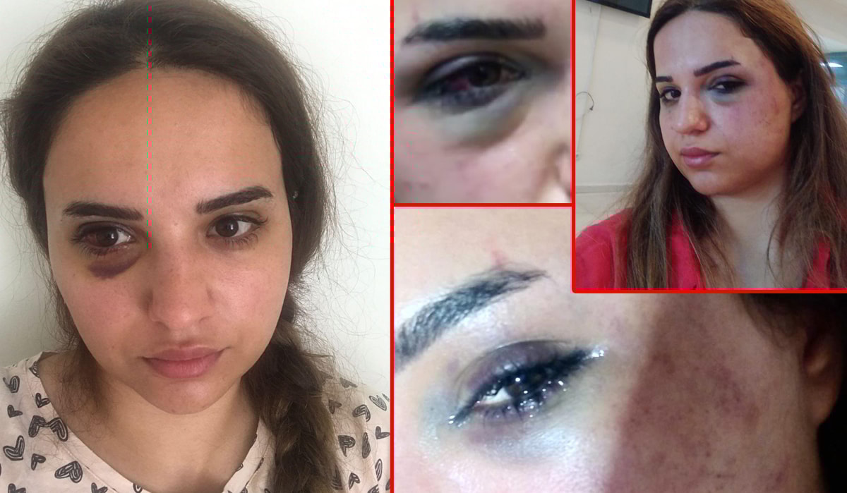 Bir yıldır boşanmak istediği eşi Leyla'yı bu hale getirdi