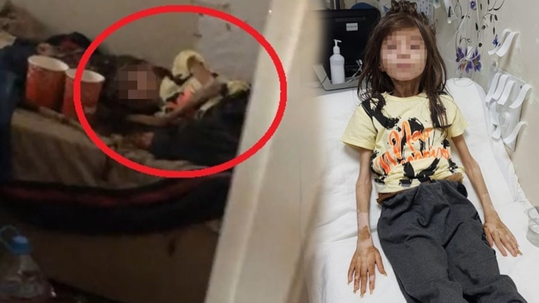 Yeğenini çöp evde açlığa hapsetmişti... Teyzenin cezası belli oldu