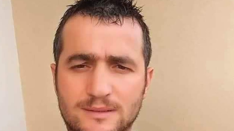 Dudağından sokan arı canından etti