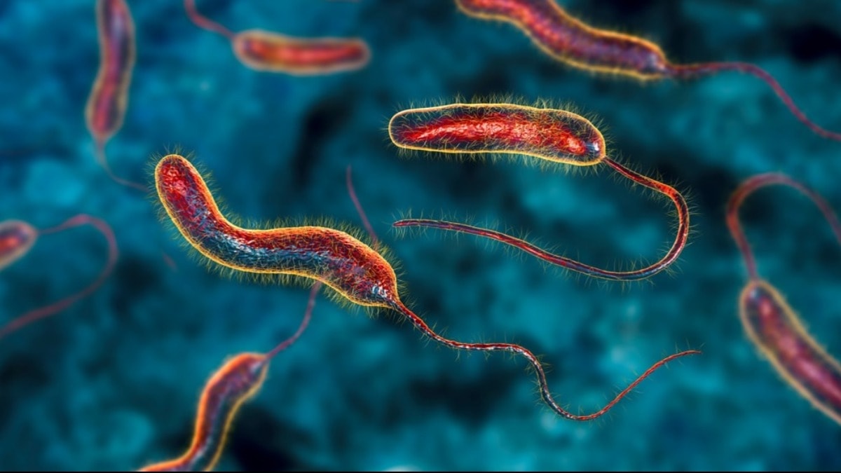 Kolera salgını yayılıyor: Yüzlerce ölü var