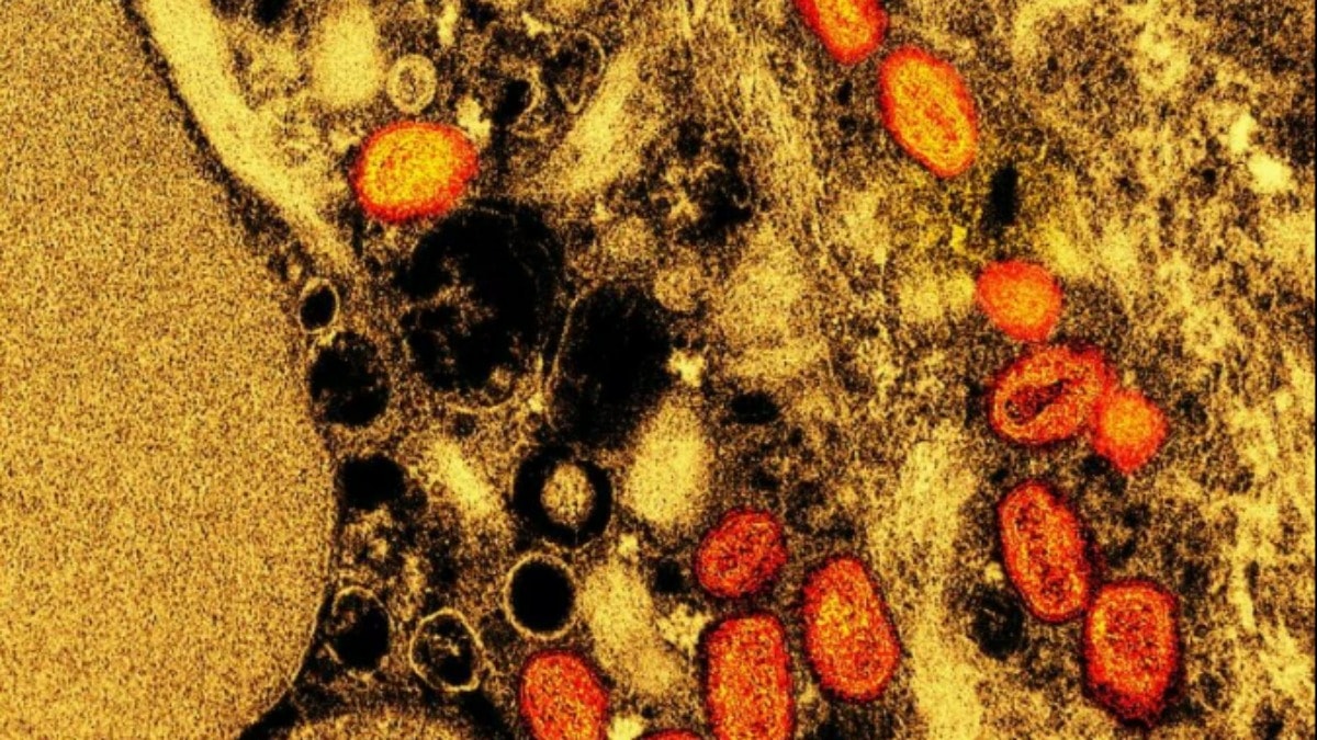 Bilim insanları endişeli: Maymun çiçeği suşu hızla değişiyor