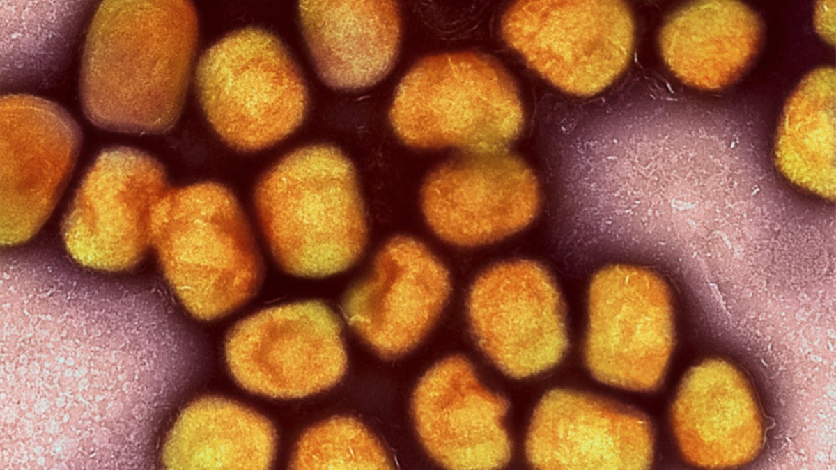 Bir ülkede daha mpox tespit edildi: Hasta BAE'den gitmiş