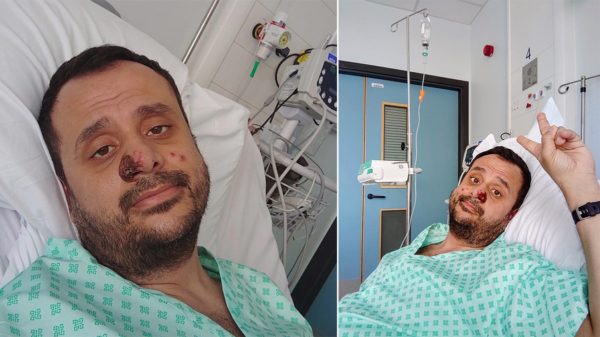 Maymun çiçeği geçiren Harun yaşadıklarını anlattı: Çok büyük ızdırap çektim