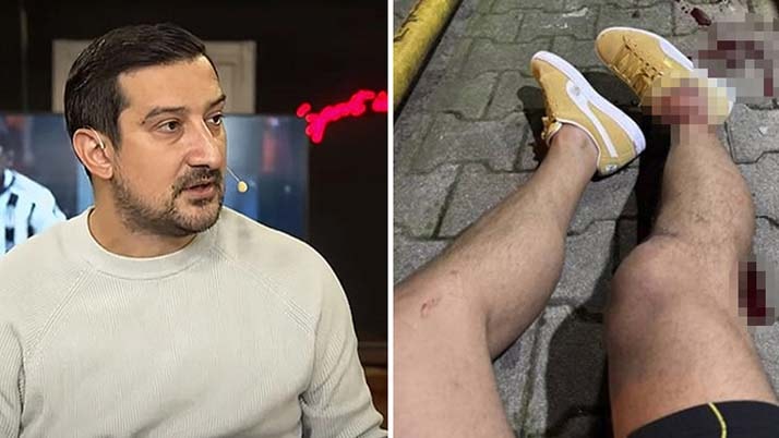 Eski futbolcu Serhat Akın'a silahlı saldırı: 'Program çıkışı ayaklarıma sıktılar'