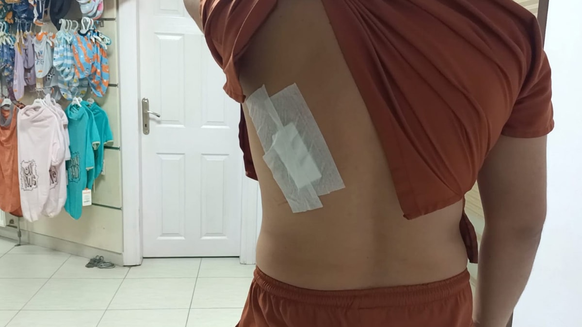 Veteriner hekime sopa ve bıçaklı saldırı