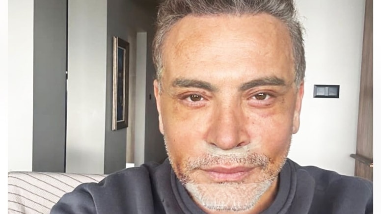 Cenk Eren: Böyle görünmek için estetik ameliyatı oldum