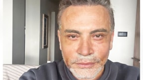 Cenk Eren: Böyle görünmek için estetik ameliyatı oldum