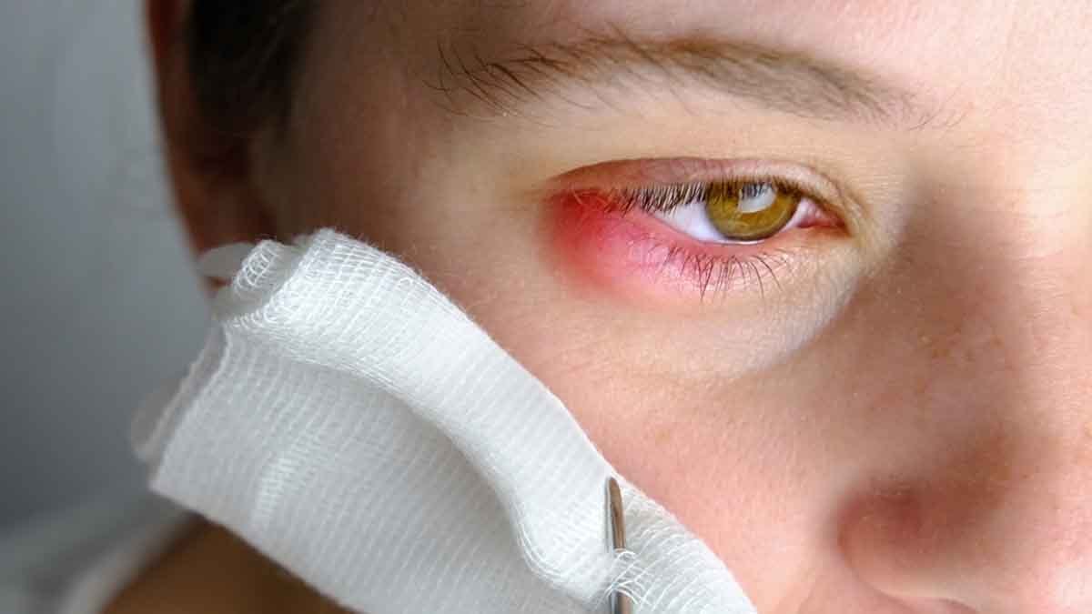 Gözleri kanatan ölümcül virüs salgını: 8 kişi öldü, işte belirtiler