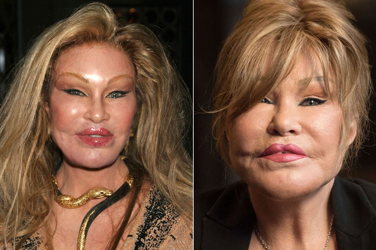 Servetini estetikle eriten 'Kedi Kadın' hayatını kaybetti