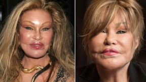 Servetini estetikle eriten 'Kedi Kadın' hayatını kaybetti