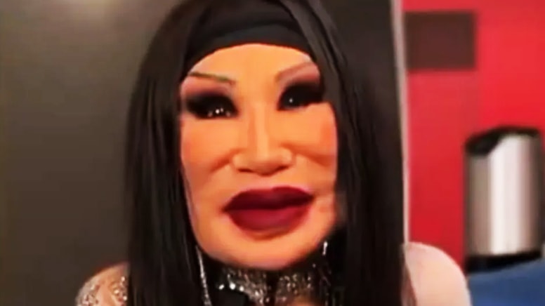 Ünlü oyuncunun yüzüne yemek yağı enjekte edildi! Hayatı cehenneme döndü