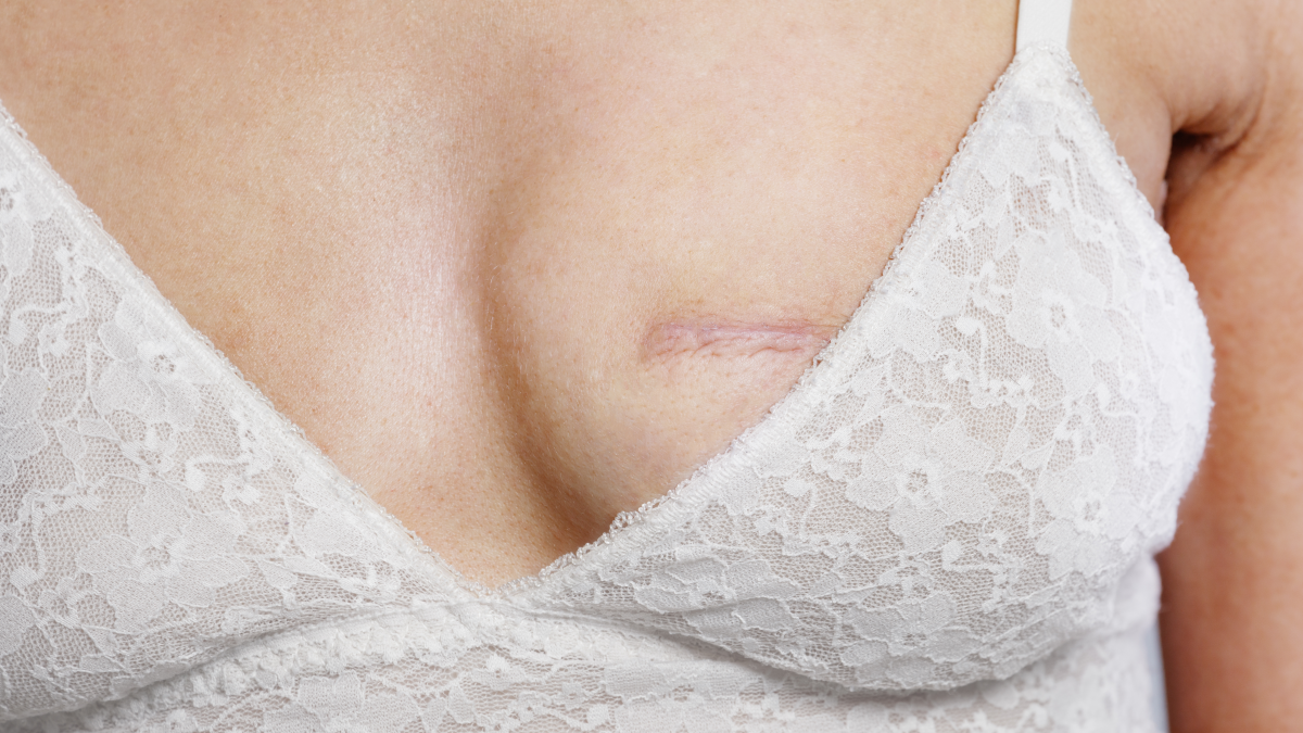 Memenin boyutu meme kanserinin habercisi: Uzmanlar kadınları uyardı