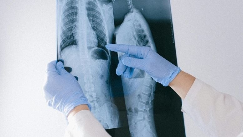 Nefes darlığı şikayetiyle hastaneye gitti! Tümörün büyüklüğü doktorları dahi şaşırttı