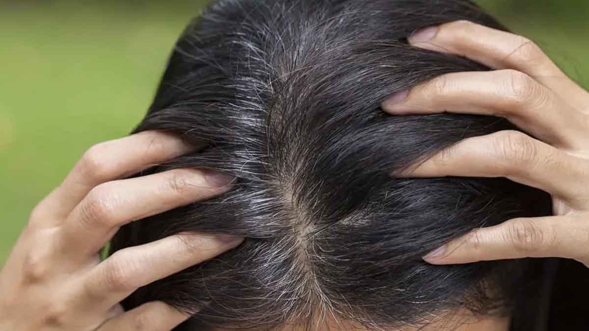 Z kuşağının saçları daha hızlı beyazlıyor: Nedeni saç boyası değil, bilimsel bir cevabı var!