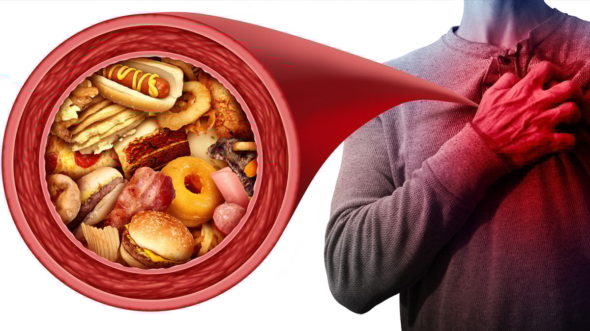 Kalp sağlığınızı koruyun: Uzak durmanız gereken 4 besin