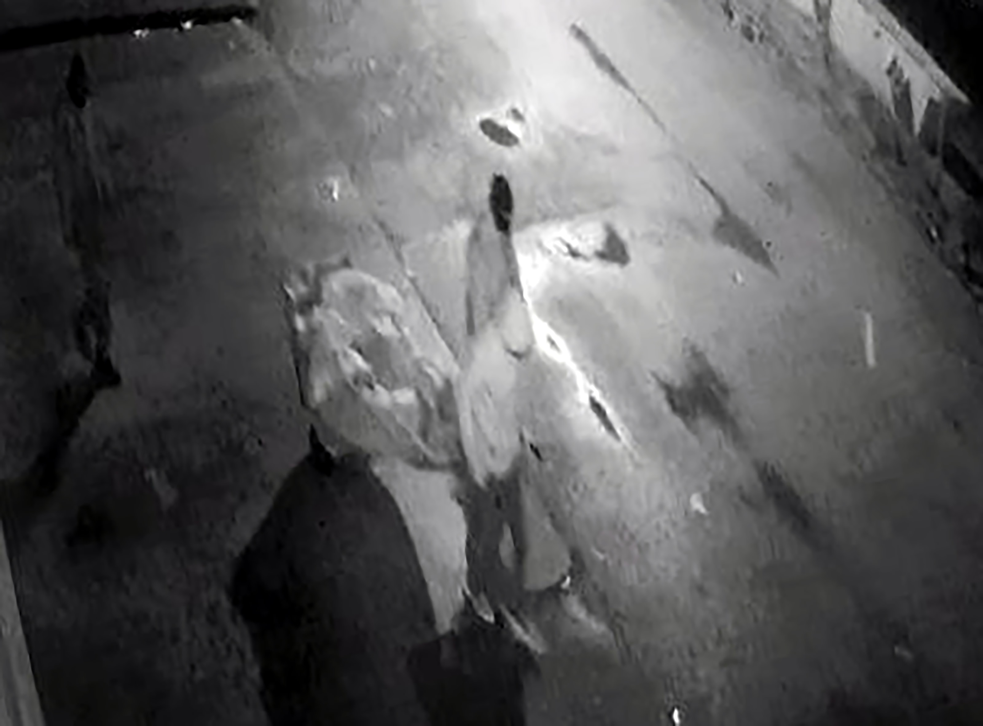 İç çamaşırı azılı hırsızı yakalattı! Bağırsak problemleri başına dert oldu