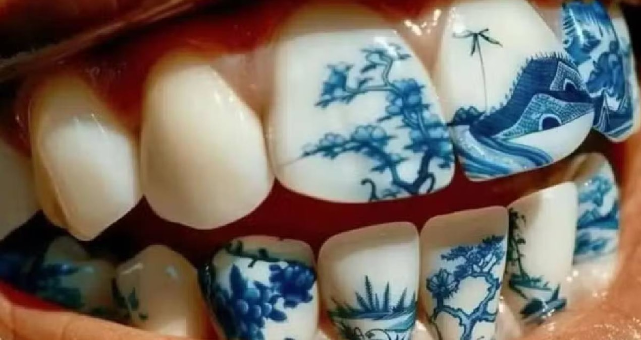 Diş dövmeleri estetik trend olarak hızla yaygınlaşıyor, ancak uzmanlar uyarıyor