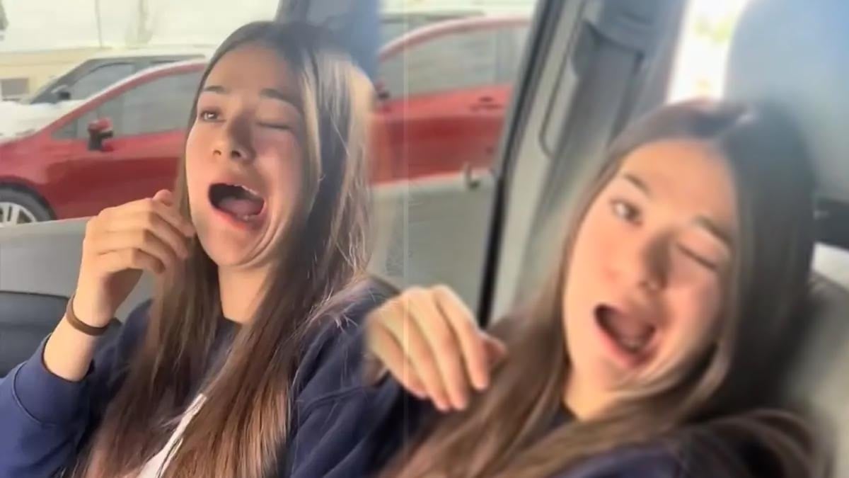 Genç kızın birden ağzı kaymaya başladı! O anlar kameraya kaydedildi