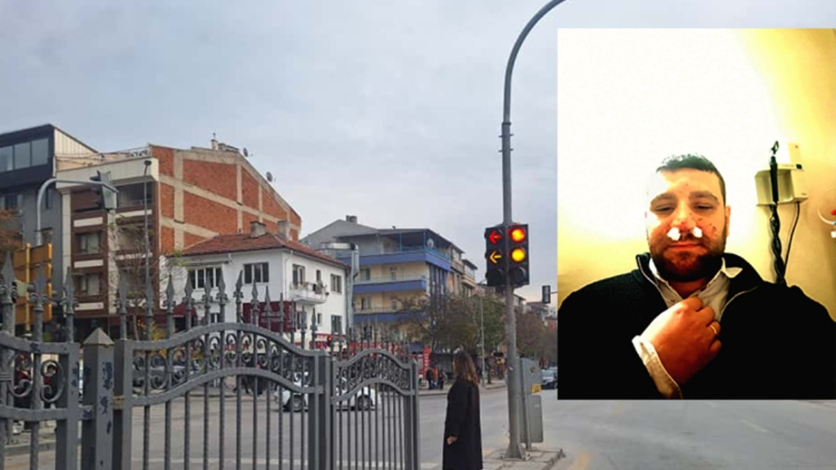 Trafik tartışmasında avukatın burnunu kırdılar