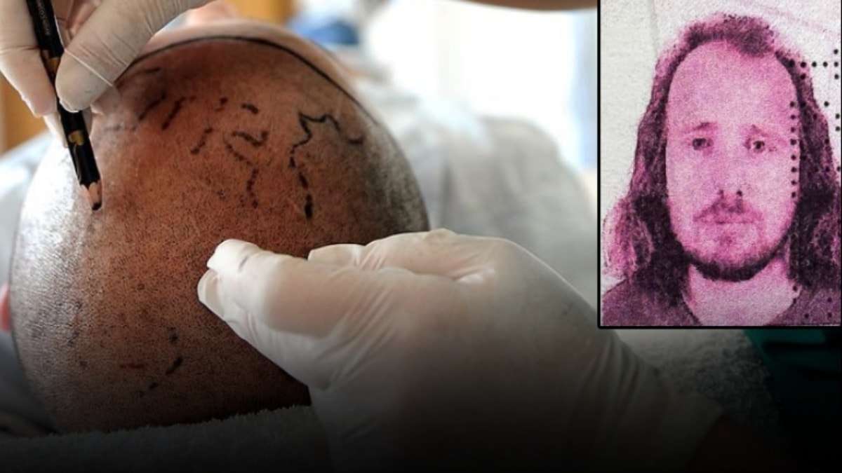 Saç ekimi ve diş tedavisi için Türkiye'ye gelen İngiliz turist hayatını kaybetti