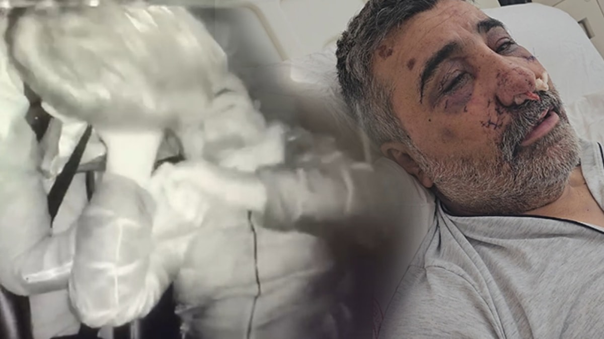 Taksiciyi öldüresiye dövdü: İngiliz boksörün mahkemedeki ifadesi ortaya çıktı