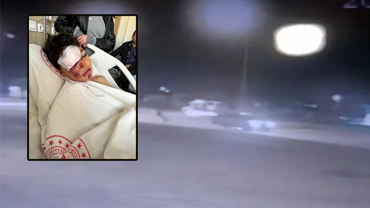 Aksaray’da 12 yaşındaki çocuğa otomobil çarptı