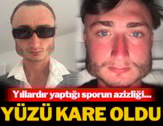 Zijn gezicht is vierkant geworden door de sport die hij al jaren beoefent