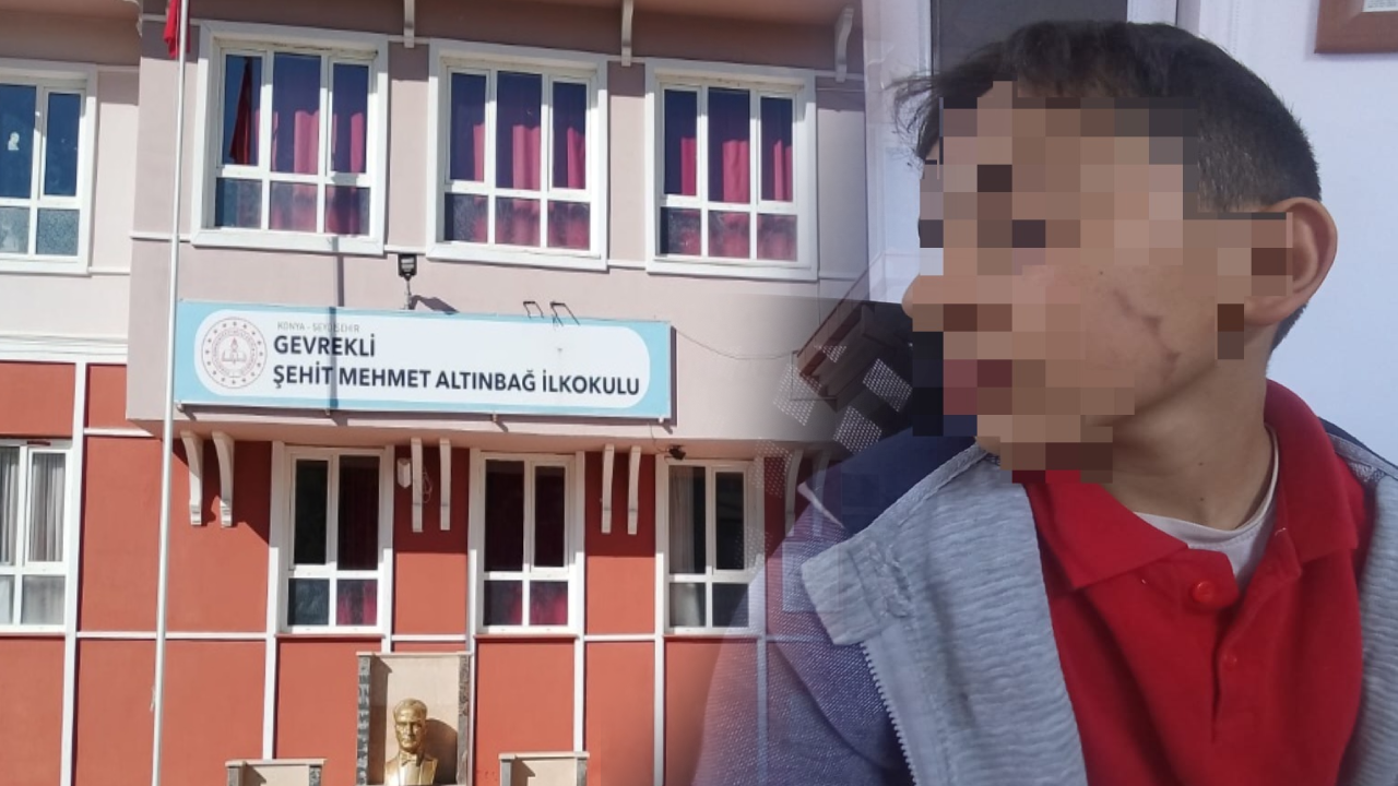 Ortaokul öğrencisine okul müdüründen darp! AKP’li başkan devreye girdi