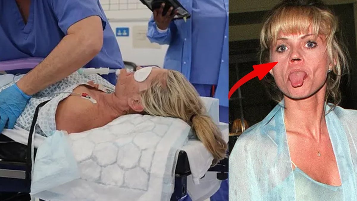 Ünlü yıldızın burun kemiği yok oldu