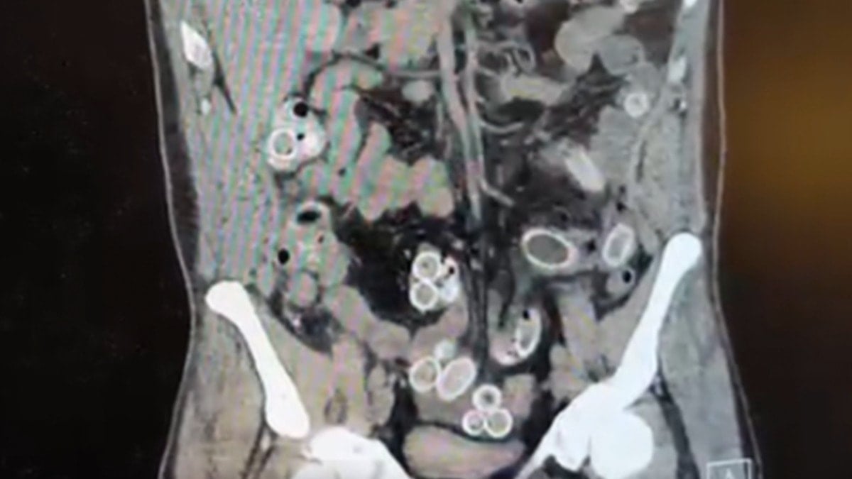 Tomografisini gören doktorlar polisi aradı, gözaltına alındı