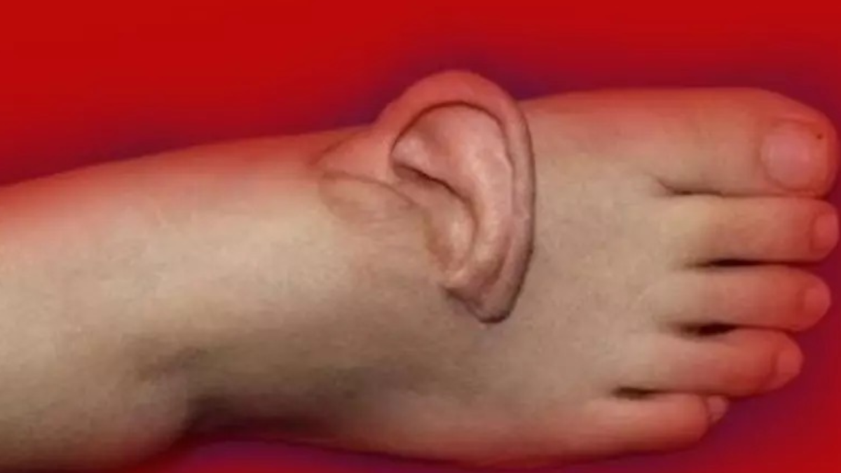 Kopan kulağını ayağına diktiler