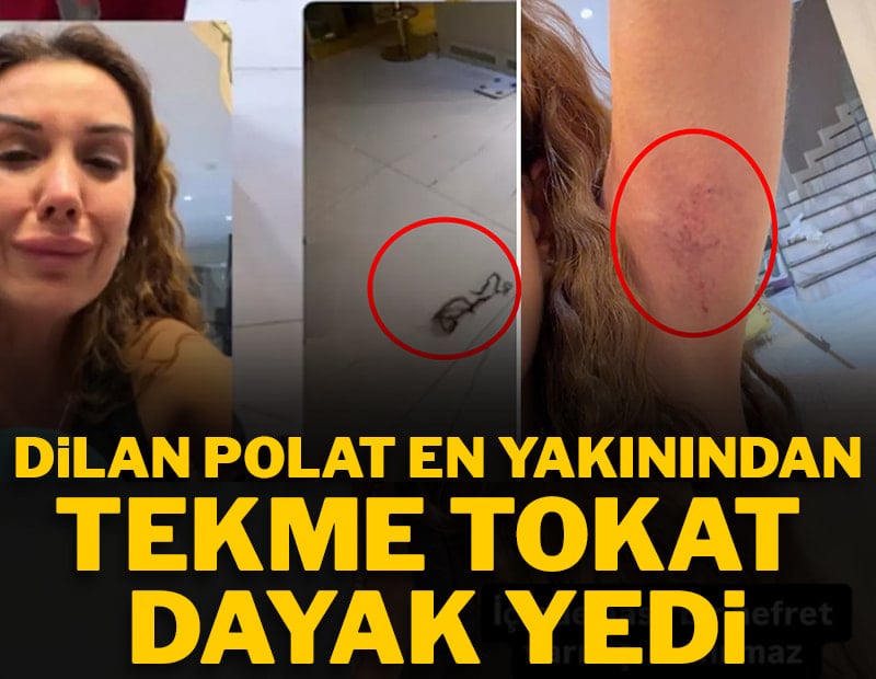 Dilan Polat en yakınından tekme tokat dayak yedi