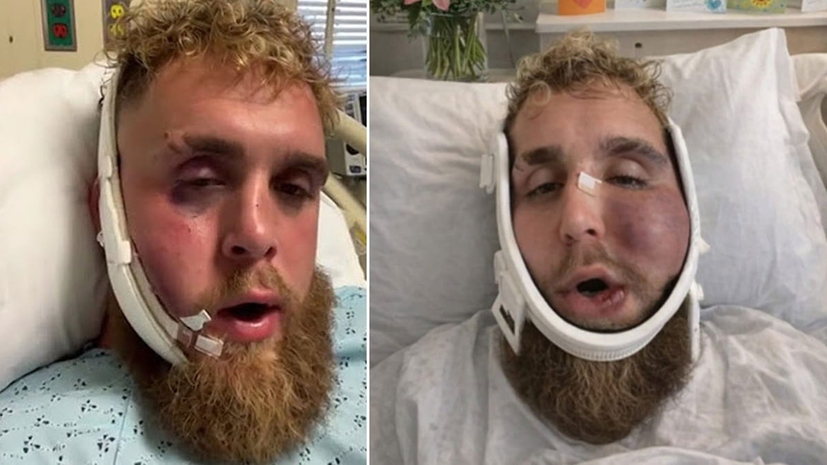 Saniyede 4 milyon TL kazandı suratı bu hale geldi