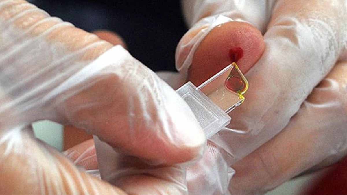 Ne A, ne B, ne de O: Yarım milyon kişiden sadece üçünün sahip olduğu çok nadir bir 'melez' kan grubu bulundu