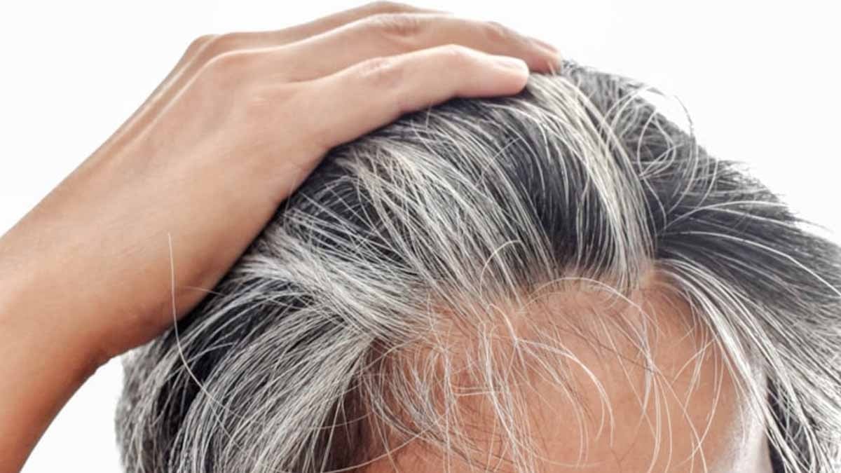 Yaşlılık belirtisi beyaz saç aslında bizi bu hastalıktan koruyormuş, riski gördüğü an pigment üretimini bırakıyor
