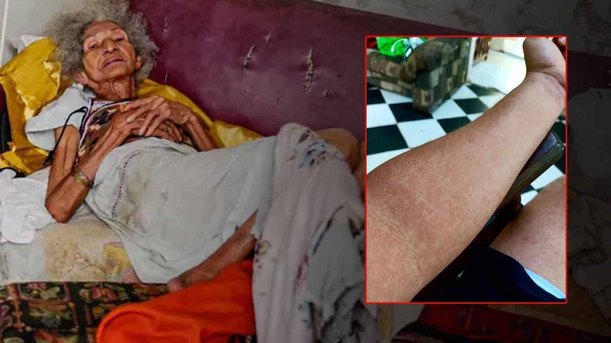 Birdenbire yaşlı insana dönüyorlar, virüs ülke halkını zombiye çevirdi! Sokaklar yürüyemeyen insanlarla dolu