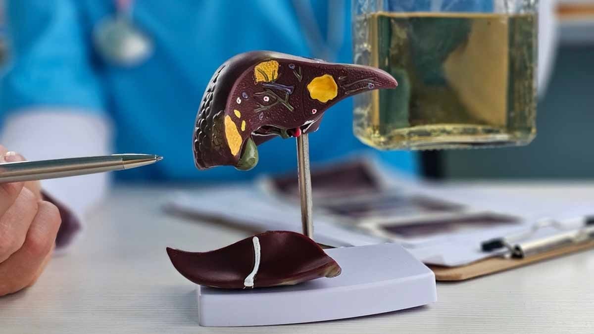 Karaciğer yağlanmasını birkaç günde tersine çeviren menü