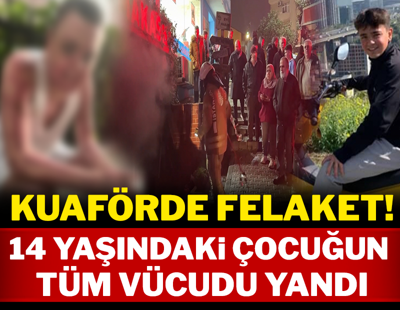 Kuaförde dehşet: 14 yaşındaki çocuğun tüm vücudu yandı!