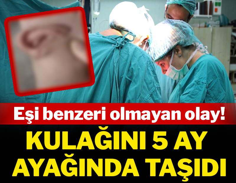 Eşi benzeri olmayan olay: Kulağını 5 ay ayağında taşıdı