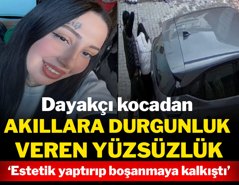 Dayakçı kocadan akıllara durgunluk veren yüzsüzlük: Estetik yaptırıp boşanmaya kalkıştı