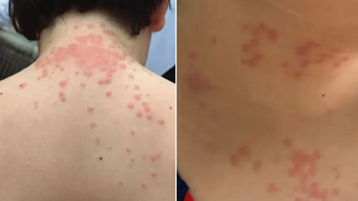 Dev hava yolunun uçaklarını böcekler bastı: Yolcular perişan hale geldi