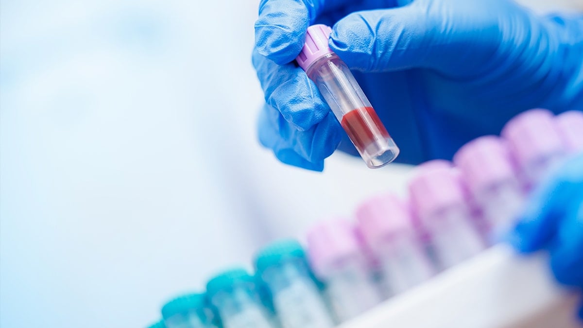 Yasaklı madde testlerinde bilinen yanlışlar neler? Saç boyatmak, su içmek, tırnak kesmek…