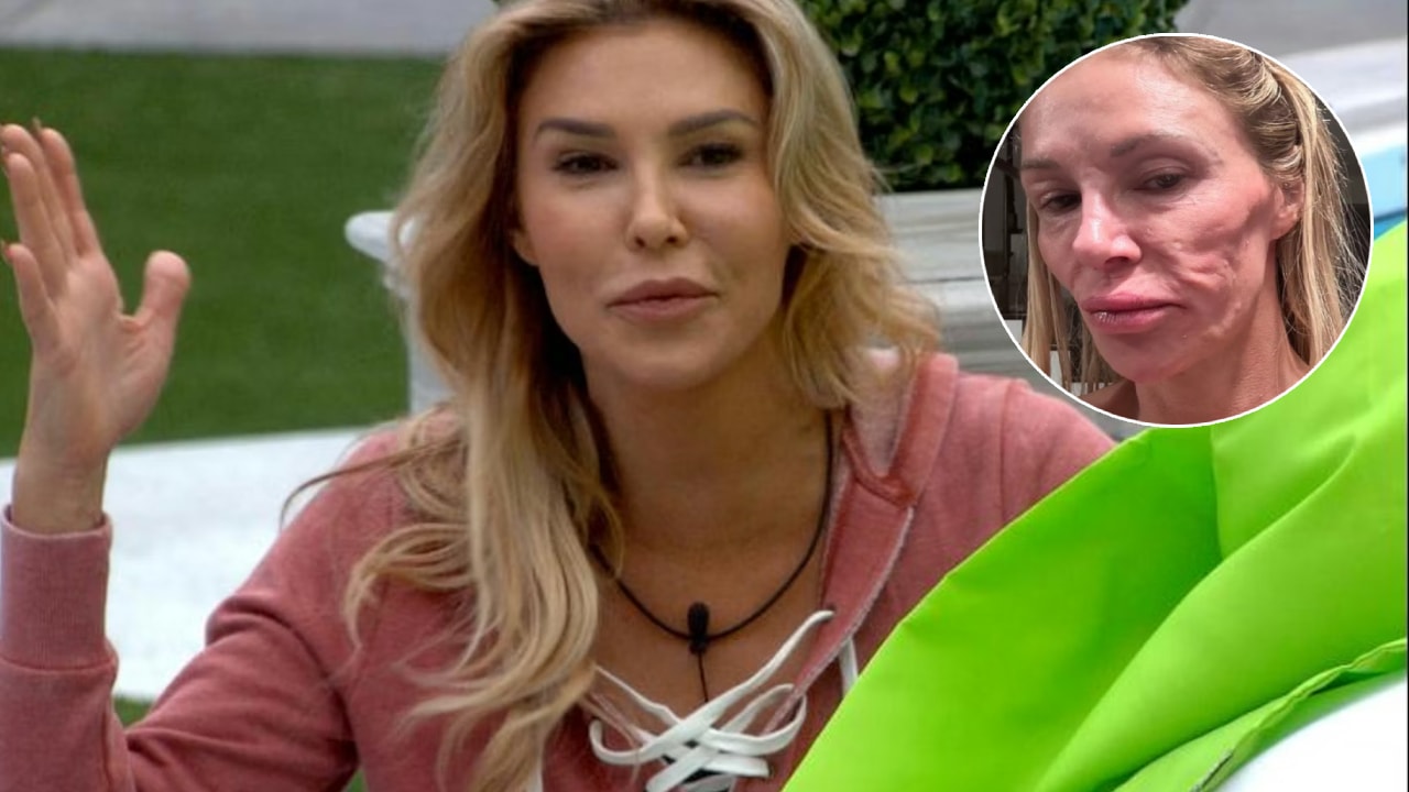 Ünlü televizyon yıldızının yüzü tanınmaz hale geldi! Teşhis konulana kadar 130 bin dolar harcadı