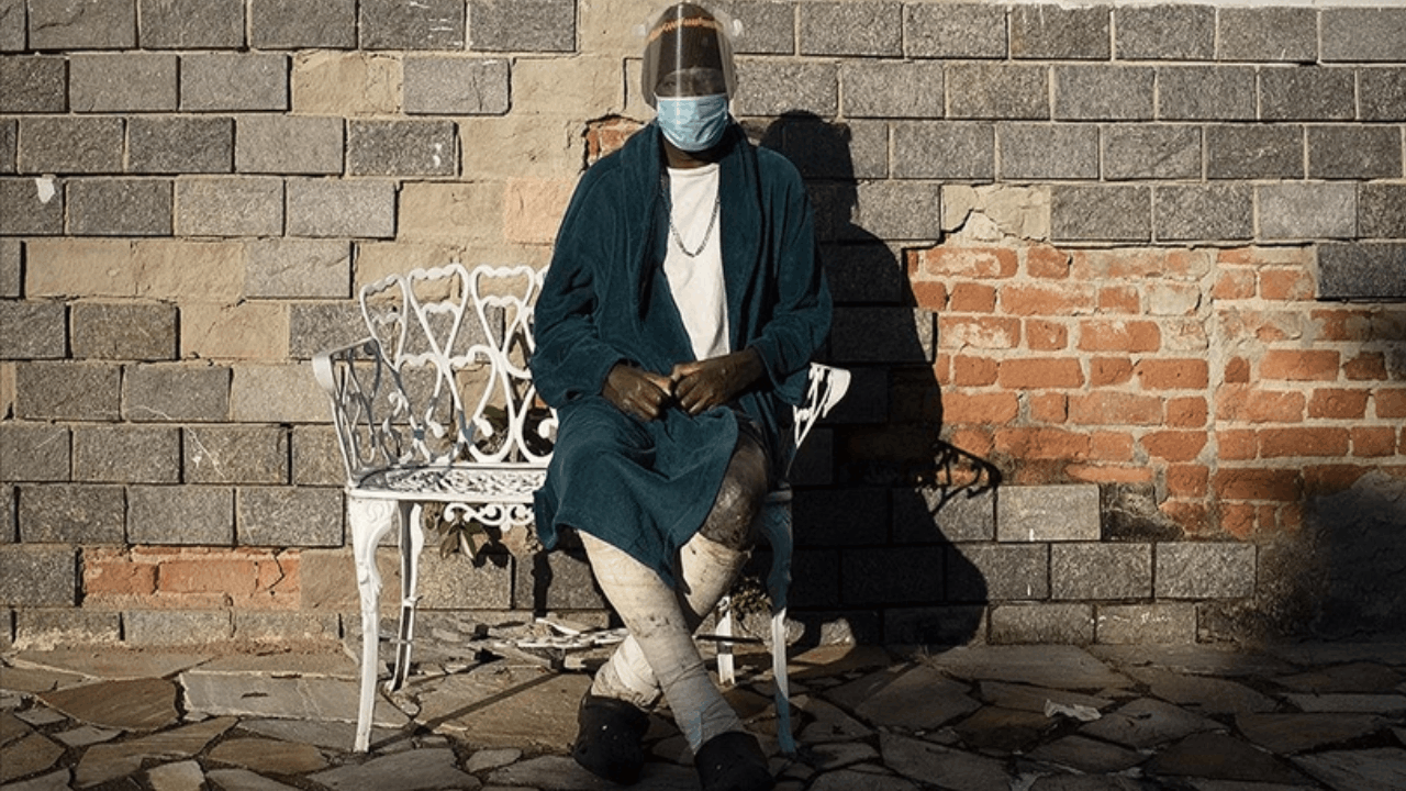 30 yıl sonra geri dönenn kabus: 2 ülkede cüzzam paniği!