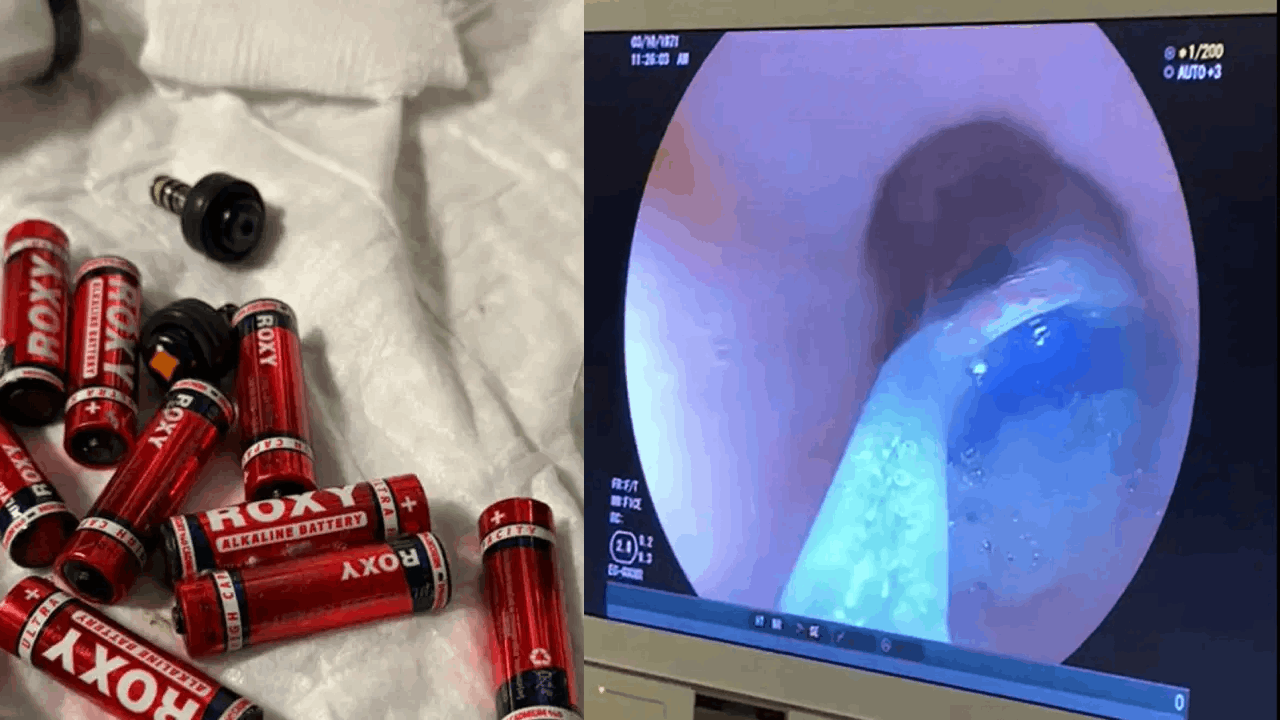 Cezaevinde korkunç olay: 9 pil, 3 jilet yuttu!