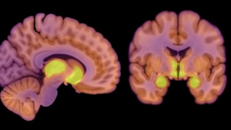 Aynada kendini kilolu görüp eriyip bitiyorlardı... Sebebi çok farklı çıktı